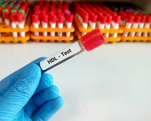 Анализ крови на ВИЧ и гепатит: особенности и правила подготовки