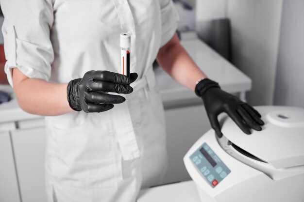 Показатель plt в анализе крови: объяснение и интерпретация данных