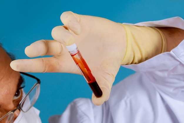 Анца анализ крови: суть и значение