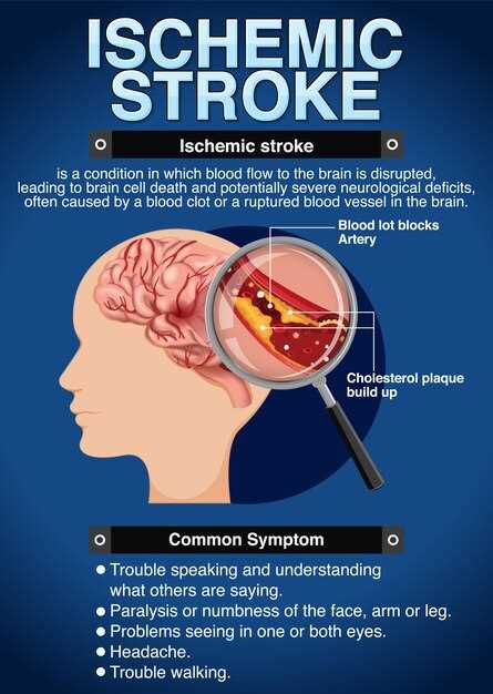 Причины и симптомы инсульта и инфаркта головного мозга
