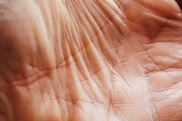 Как устранить гусиную кожу: эффективные методы