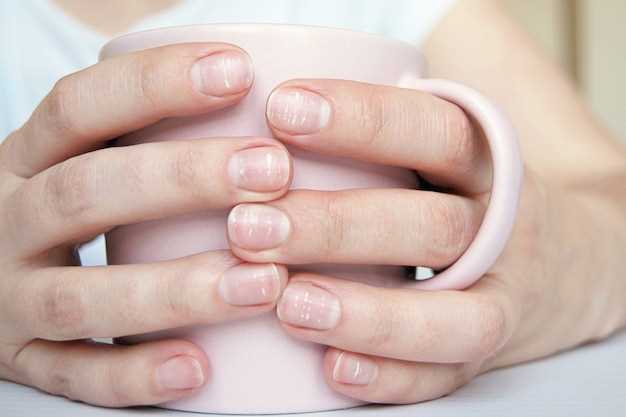 Причины исчезновения лунок на ногтях рук