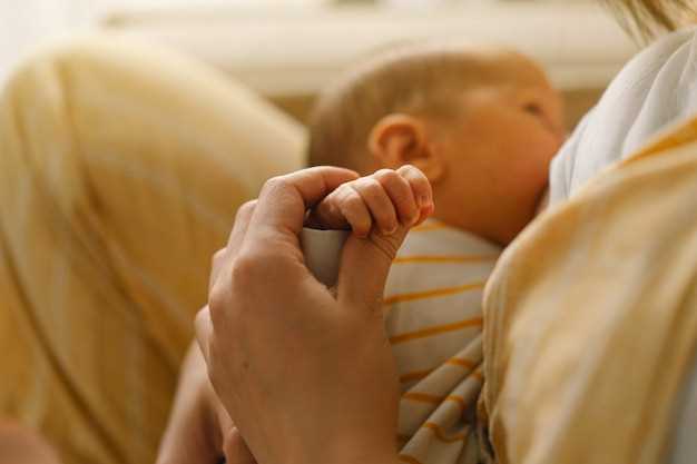 Причины опрелостей у новорожденного и способы их предотвращения