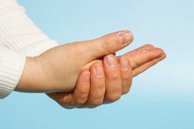 Причины и симптомы бородавок на пальцах