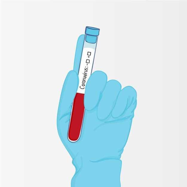 Как правильно провести экспресс тест на ВИЧ