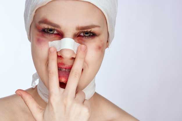 Признаки и симптомы, указывающие на перелом носа