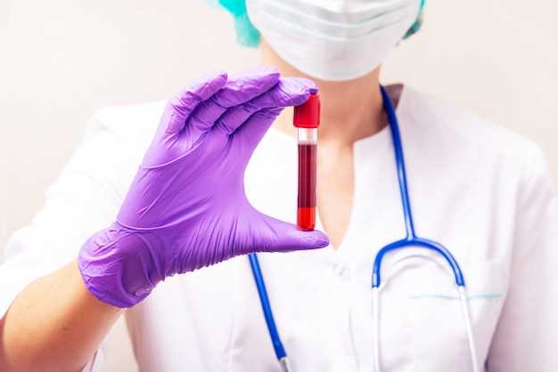 Как получить точные результаты анализа крови на гормоны щитовидной железы