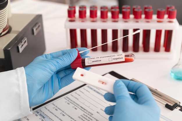 Что такое гемоглобин и зачем нужно сдавать кровь на него
