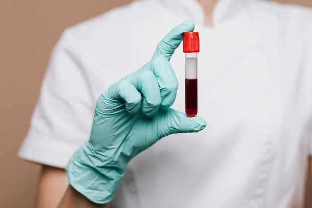 Как готовиться к анализу на гемоглобин и правила сдачи крови
