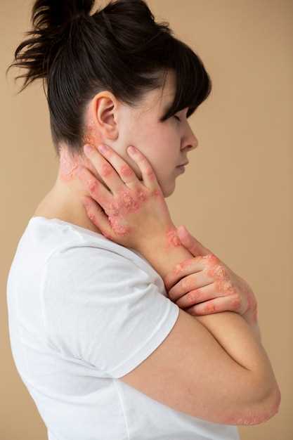 Естественные методы для быстрого снятия воспаления лимфоузлов на шее