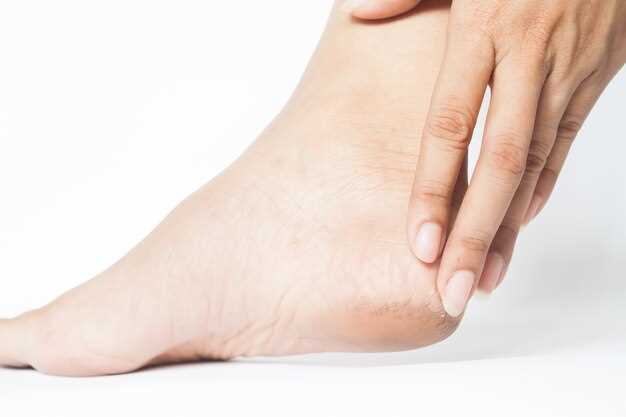 Лечение грибка ногтя на ноге большого пальца