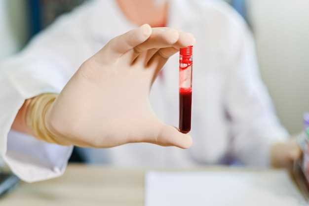 Как выглядит результат общего анализа крови?