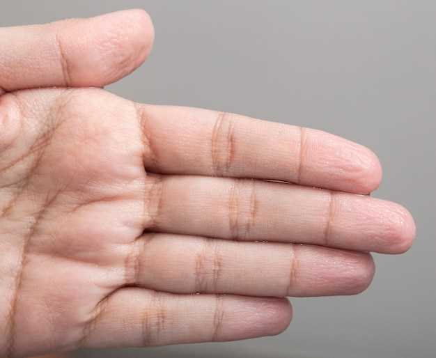 Симптомы трескающейся кожи на пальцах