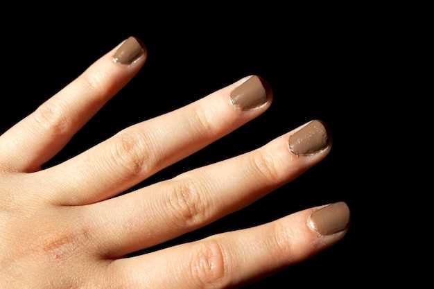 Причины трескающейся кожи на пальцах