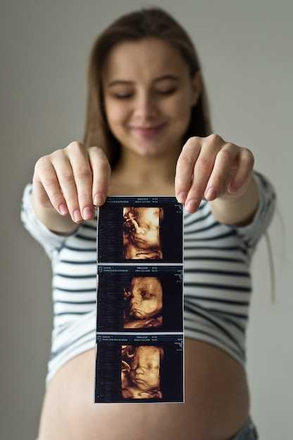 Ранние признаки родов у женщин, ожидающих первого ребенка